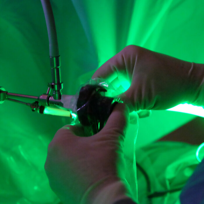 Mit dem grünen Licht des Greenlightlasers wird eine gutartige Vergrößerung der Prostata („benigne Prostatahyperplasie“, abgekürzt BPH) sehr schonend behandelt. Das grüne Laserlicht ist optimal auf die Absorptionsfähigkeit der Blutgefäße in der Prostata abgestimmt. (Foto: M. Boeckh)