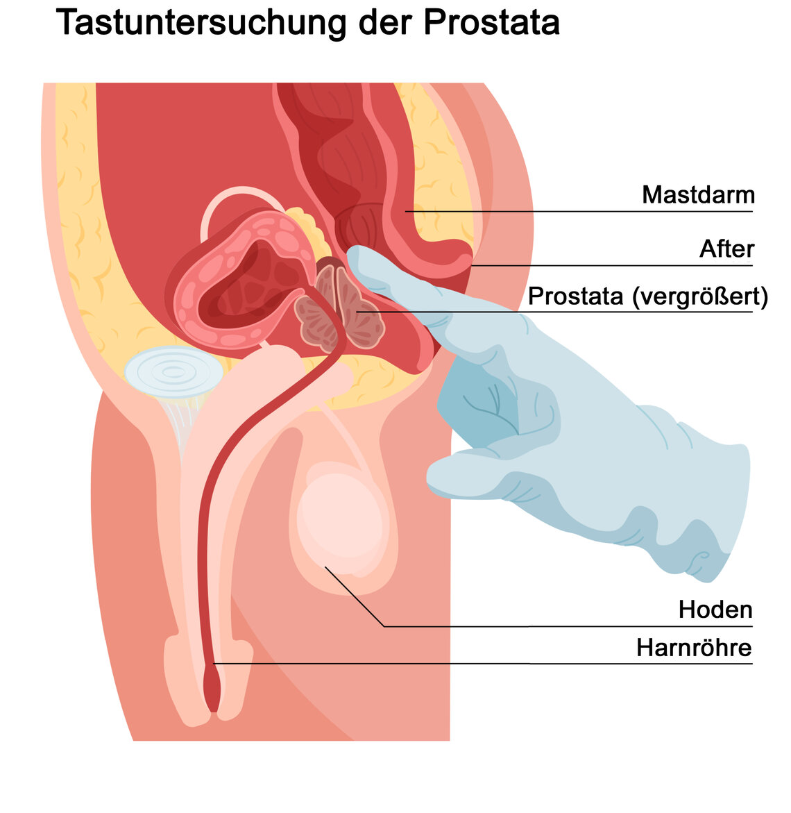 Grafik Tastuntersuchung