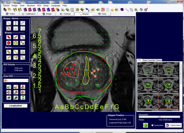 Magnetresonanz-Tomographie-Aufnahme 
