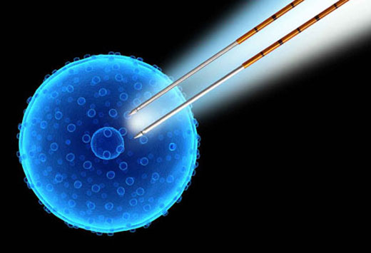 При терапии IRE вокруг игольчатых зондов образуется импульсное электрическое поле, которое раскрывает клеточные мембраны в области примен